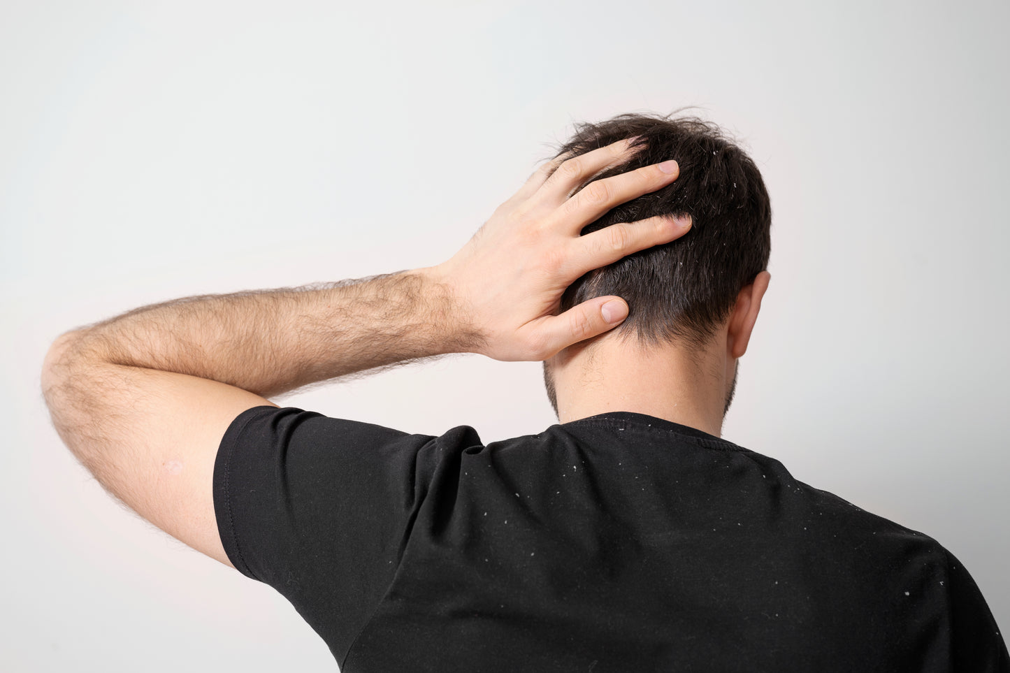 HAIR GROWTH PREVENT HAIR LOSS